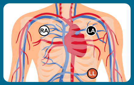 3 导联 ECG 心电图机测试