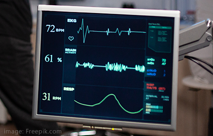 ECG 滤波器