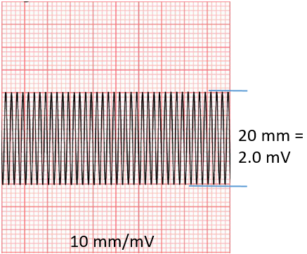 輸入正弦波(20Hz、2mV)待測設備導聯I顯示的幅度 輸入正弦波(20Hz、2mV)待測設備導聯I顯示的幅度