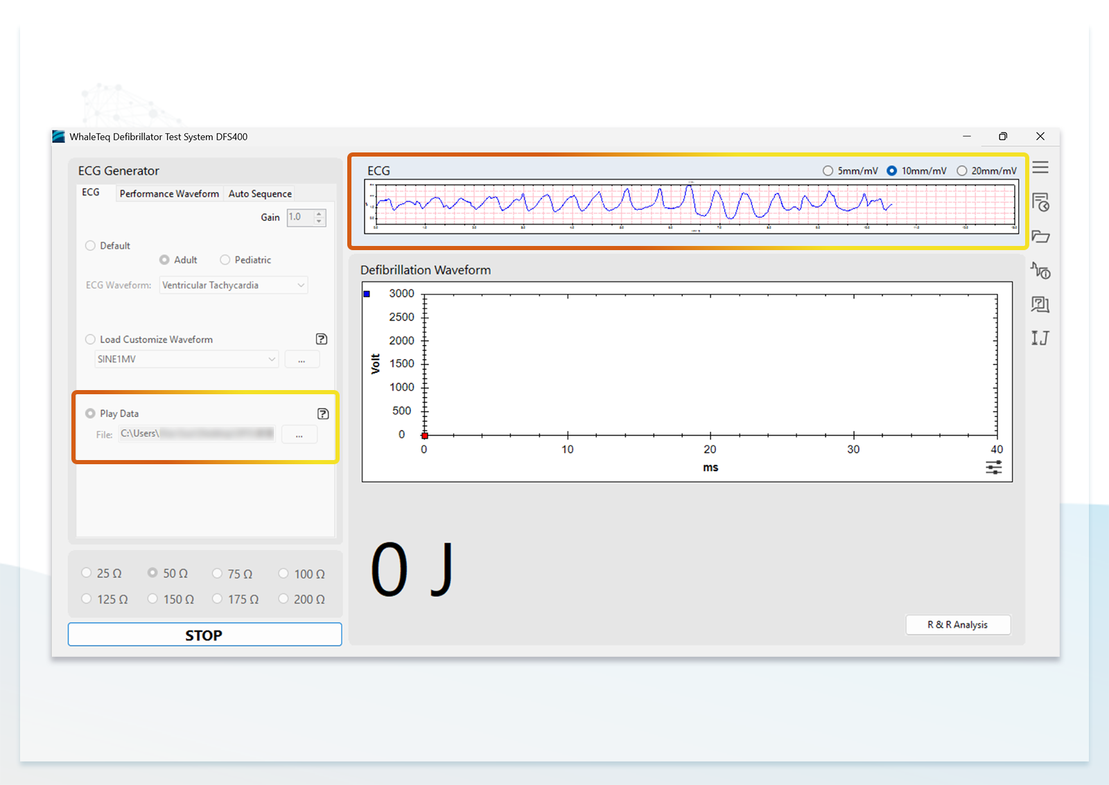 DFS400 AED/Defibrillator Tester Supports playback of ECG databases, and reproduces clinically recorded or user-defined waveforms for repeated verification to facilitate the development process.